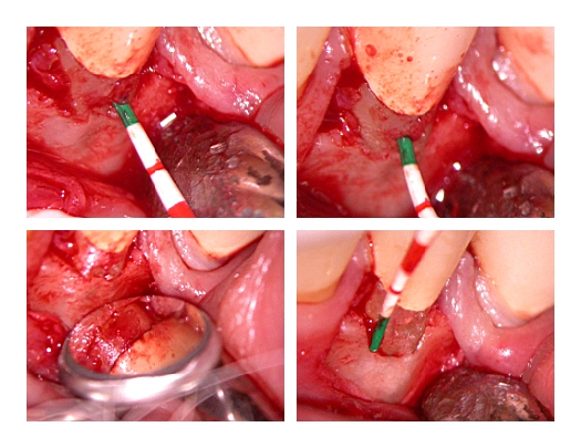 root resorption_Page2.jpg